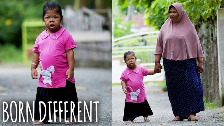 Saya Berusia 26 Tahun – Dan Terjebak Dalam Tubuh Balita | LAHIR BERBEDA